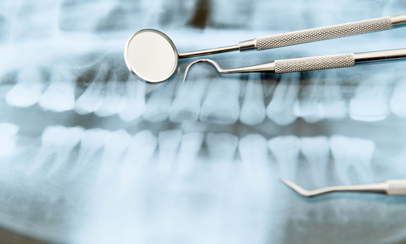 Gum Disease Claims