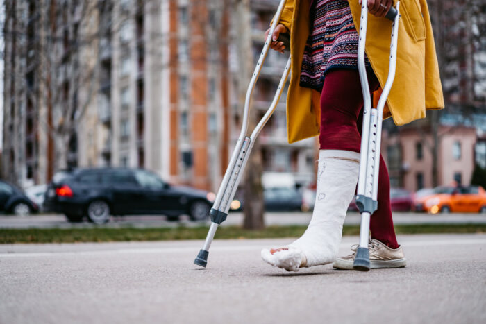 heel fracture